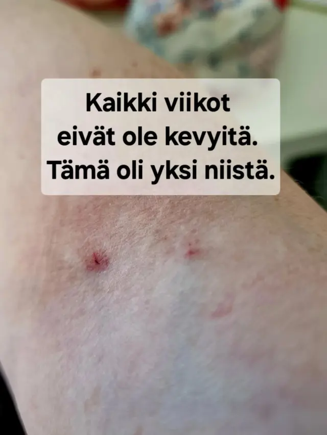 Tämä viikko tuntui raskaalta.

Kävin verikokeessa ja sanoin heti:
olen hankala pistettävä, kipuherkkä, ja suonet eivät ole helpot.
Silti… ei oikein kuunneltu.

Sorkittiin, etsittiin, pistettiin kahteen kertaan.
Pieni asia ehkä jollekin. Mutta kun olet valmiiksi väsynyt, se tuntuu paljon suuremmalta.

Ja jotenkin koko viikko meni samalla fiiliksellä:
vähän sumussa, vähän epämukava olo omassa kehossa.
Mutta silti, näissä kuvissa on myös niitä hetkiä:

☕ rauhaa
🐾 seuraa
🍽️ hyvää ruokaa
🌫️ kauneutta keskellä harmaata

Ehkä elämä on juuri tätä tasapainoilua.
Ei täydellistä. Ei helppoa. Mutta silti elettyä.

💬 Onko sua joskus jätetty kuuntelematta tilanteessa, jossa sillä olisi ollut väliä?

❤️ Tallenna tämä, jos tarvitset muistutuksen:
sinun tuntemuksesi ovat totta ja ne ansaitsevat tulla kuulluiksi

#arjenrealismia #kaikkeaeinay #viikkofiilikset #rehellinenarki #kuulluksituleminen